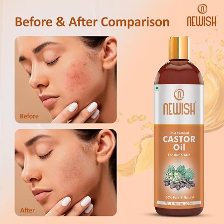 Newish 100% Pure Organic Cold-Pressed Castor Oil (200ml) – Hexane-Free Beauty Oil for Hair Growth, Eyebrows, Eyelashes & Cracked Heel Repair