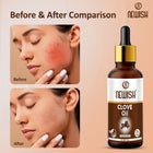 Newish Clove Essential Oil for Hair, Skin & Aromatherapy
