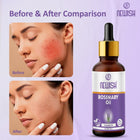 Newish Rosemary Essential Oil for Hair & Scalp Care